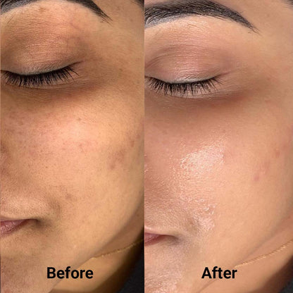 Korean Blue Copper Peptide Bakuchiol Serum