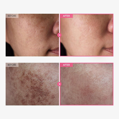 SAESKYN Advanced Arbutin Brightening Cream